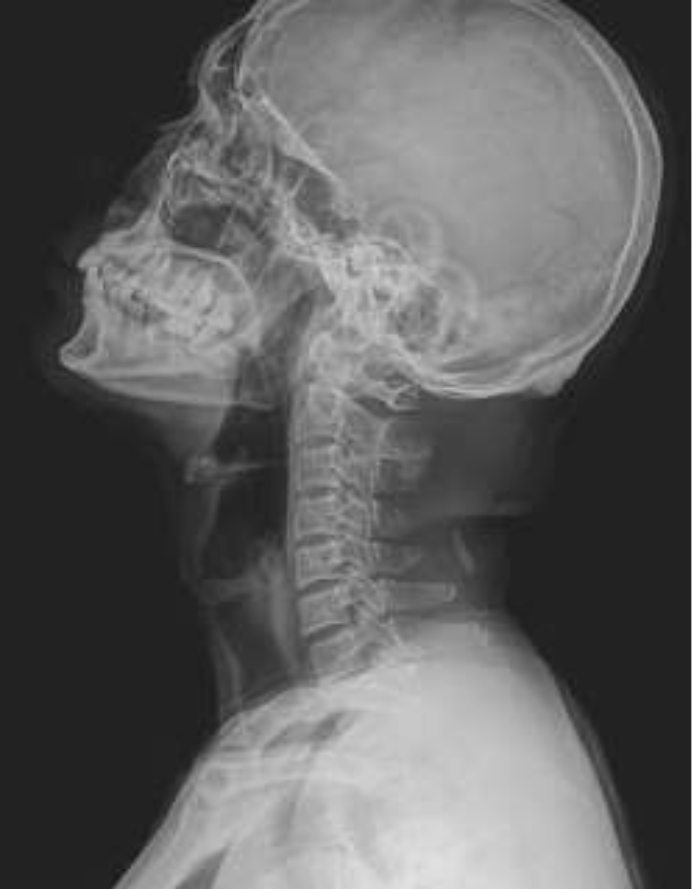 Sin%20título%20%286.7%20×%208.6 cm%29